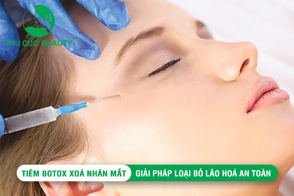 Tiêm Botox xóa nhăn mắt: Giải pháp loại bỏ lão hoá an toàn