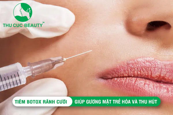 Tiêm Botox rãnh cười: Giúp gương mặt trẻ hoá và thu hút