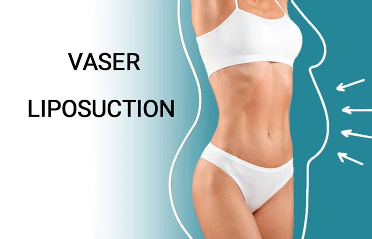 The Social Media Influence on Vaser Liposuction Trends - World News Fox