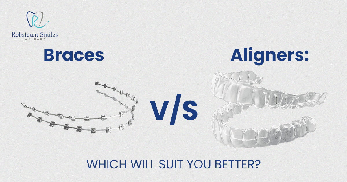 Braces vs. Aligners: Which Will Suit You Better? | Robstown Smiles