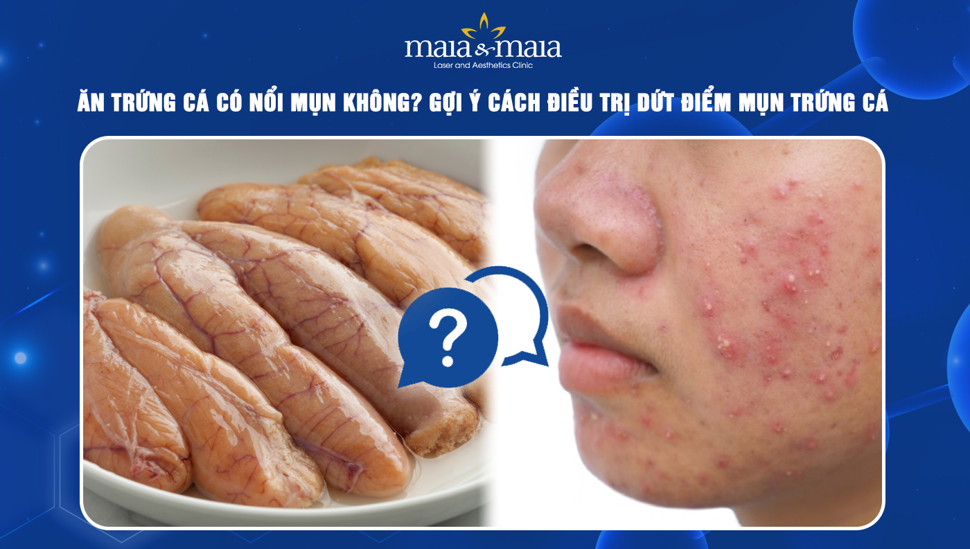 Ăn trứng cá có nổi mụn không? Gợi ý cách điều trị dứt điểm