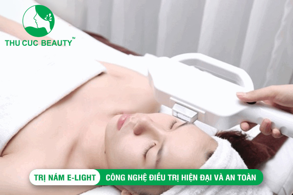 Trị nám E-light: Công nghệ điều trị hiện đại và an toàn