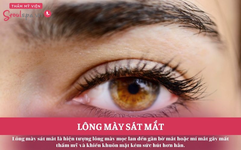 Lông mày sát mắt là gì? Ý nghĩa tướng số tốt hay xấu?