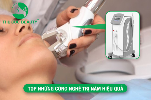 TOP những công nghệ trị nám hiệu quả, hiện nay