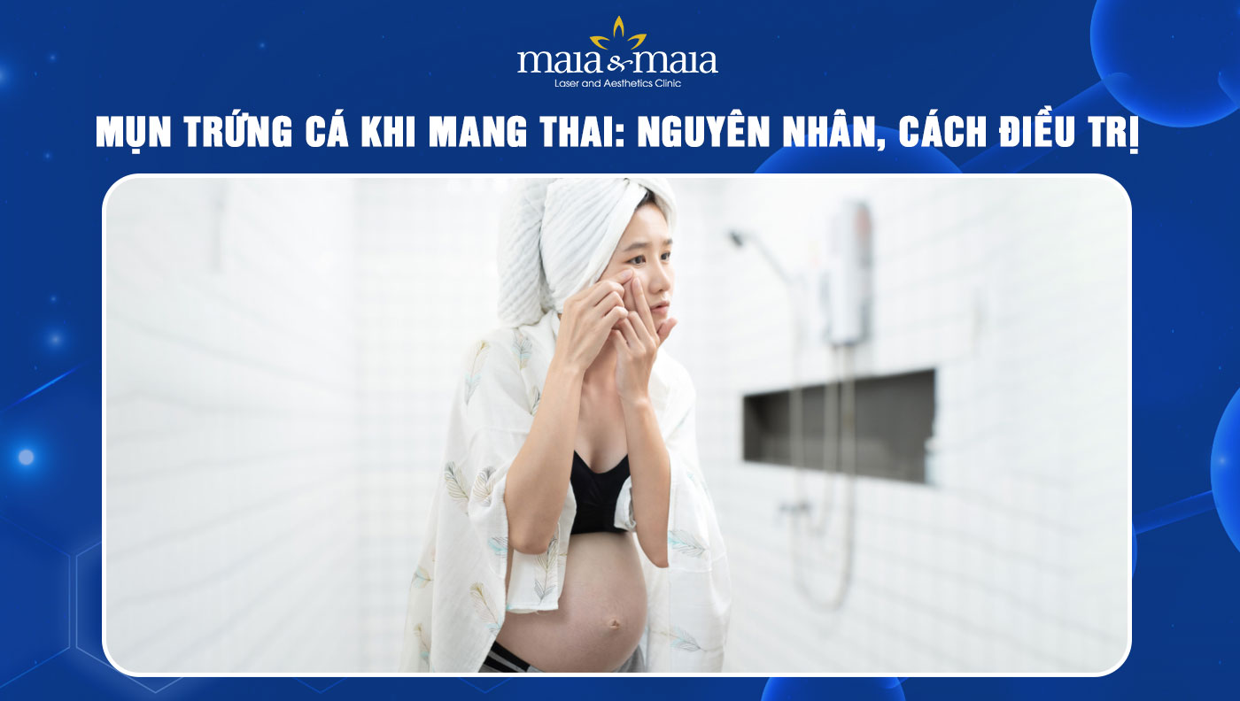 Mụn trứng cá khi mang thai: Nguyên nhân và cách điều trị