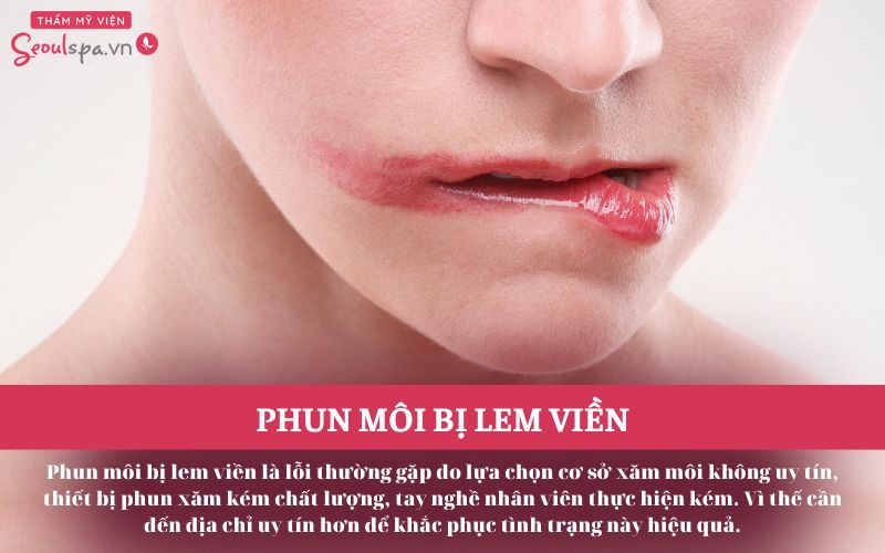 Phun môi bị lem viền: Nguyên nhân và cách khắc phục triệt để