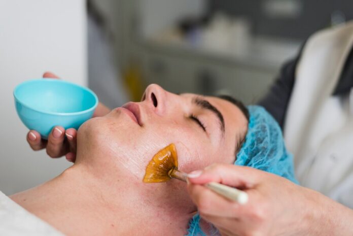 Transform Your Skin with a Chemical Peel for Acne Scar | Medium Blog