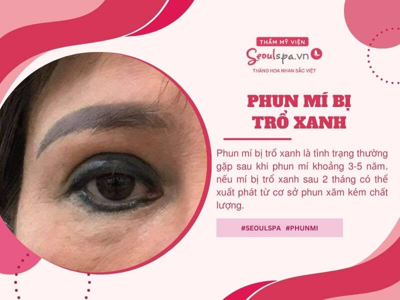 Phun mí bị trổ xanh là gì? Nguyên nhân và cách xử lý hiệu quả