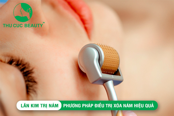 Lăn kim trị nám: Phương pháp điều trị xóa nám hiệu quả