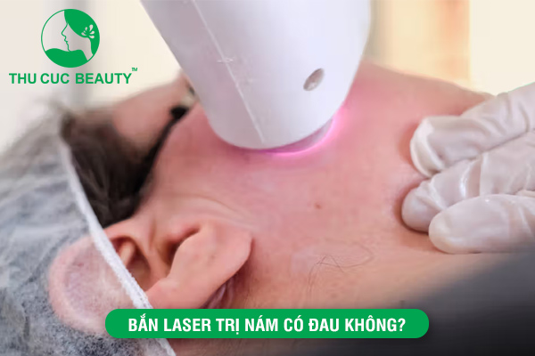 Bắn laser trị nám có đau không? - Bệnh viện Phẫu thuật Thẩm mỹ Thu Cúc