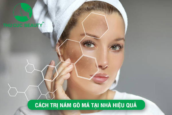 Cách trị nám gò má tại nhà hiệu quả - Bệnh viện Phẫu thuật Thẩm mỹ Thu Cúc