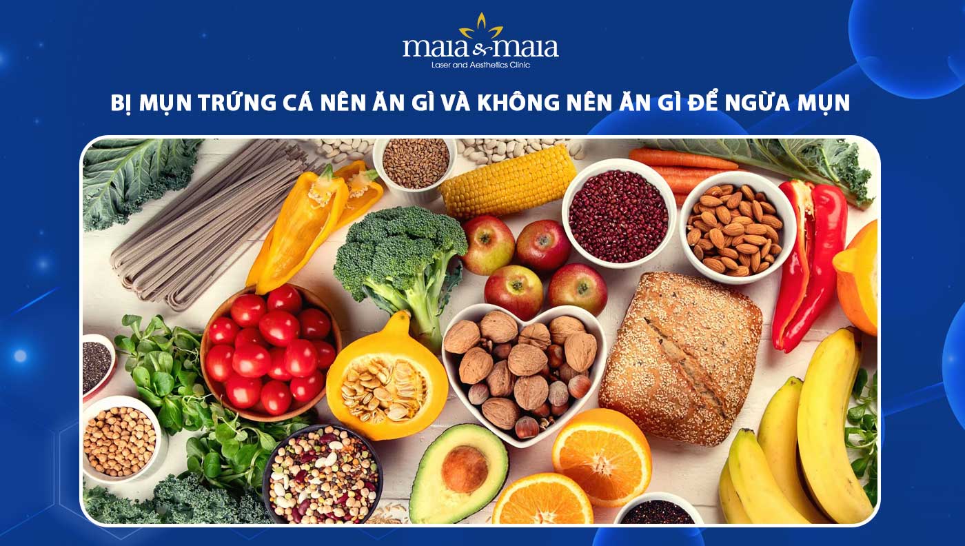 Bị mụn trứng cá nên ăn gì và không nên ăn gì để ngừa mụn