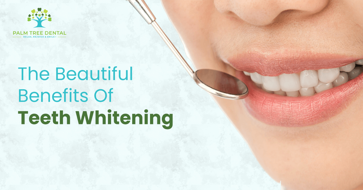 Top 5 Benefits Of Teeth Whitening | Palm Tree Dental