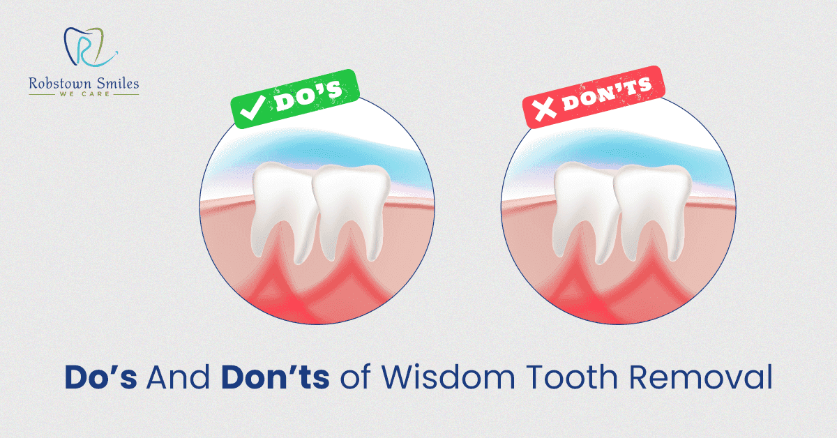 Do’s And Don’ts of Wisdom Tooth Removal | Robstown Smiles