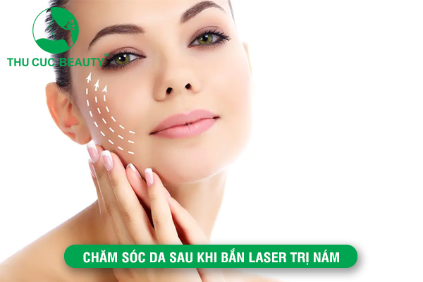 Hướng dẫn chăm sóc da sau khi bắn laser trị nám