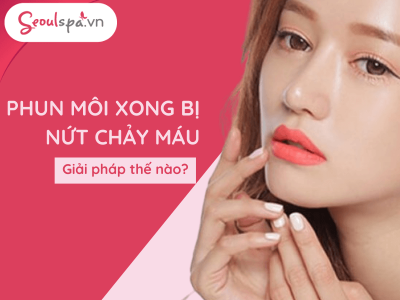 Phun môi xong bị nứt chảy máu – Nguyên nhân và cách xử lý