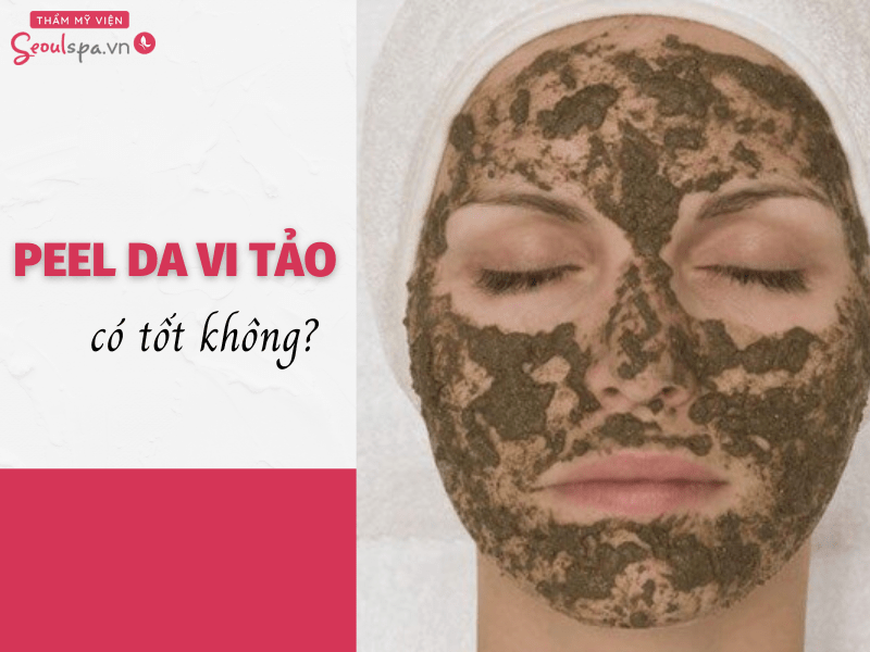 Peel da vi tảo là gì? Có tốt không? Cách peel tảo?