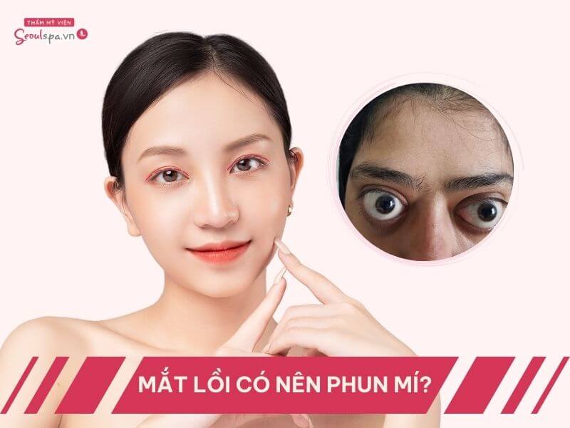 Mắt lồi có nên phun mí không? Cần lưu ý điều gì khi xăm mí?