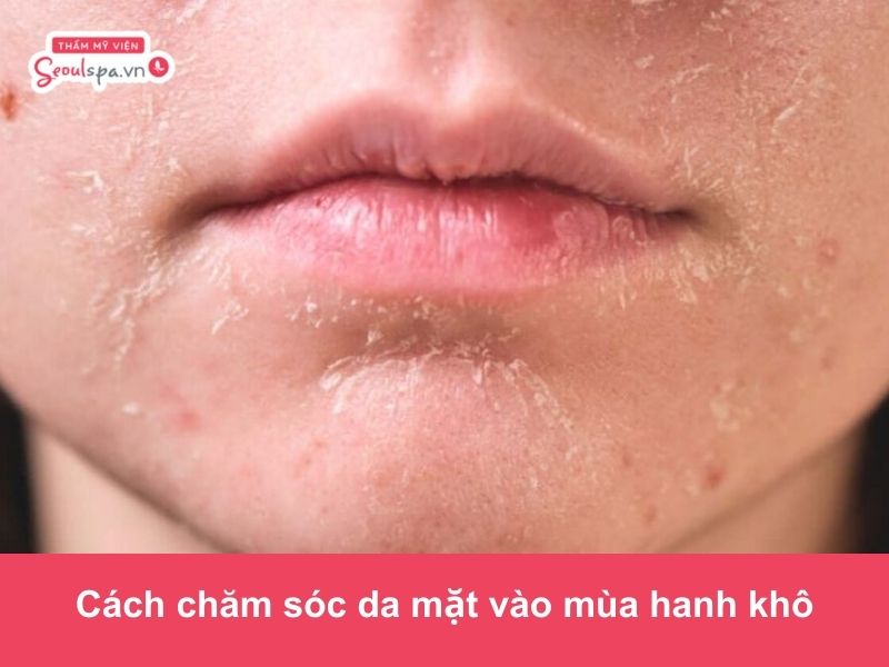 Cách chăm sóc da mặt vào mùa hanh khô từ chuyên gia da liễu