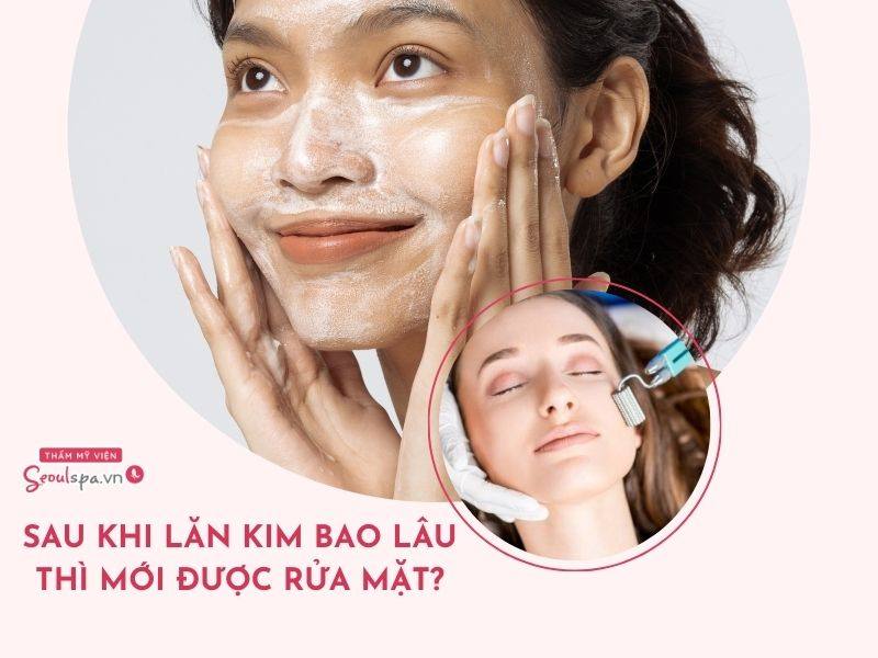 Sau lăn kim bao lâu thì được rửa mặt? Rửa mặt như thế nào?