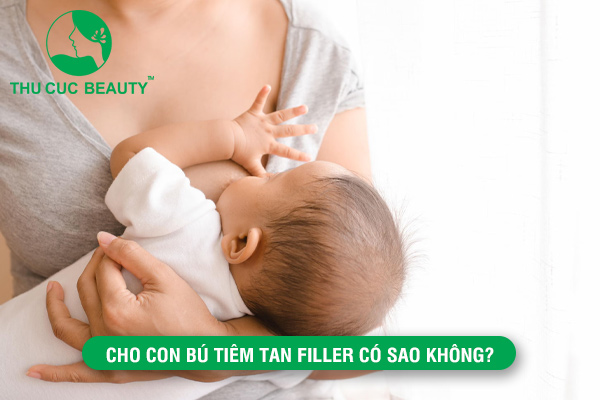 Đang cho con bú tiêm tan filler có sao không? - Bệnh viện Thẩm Mỹ Thu Cúc