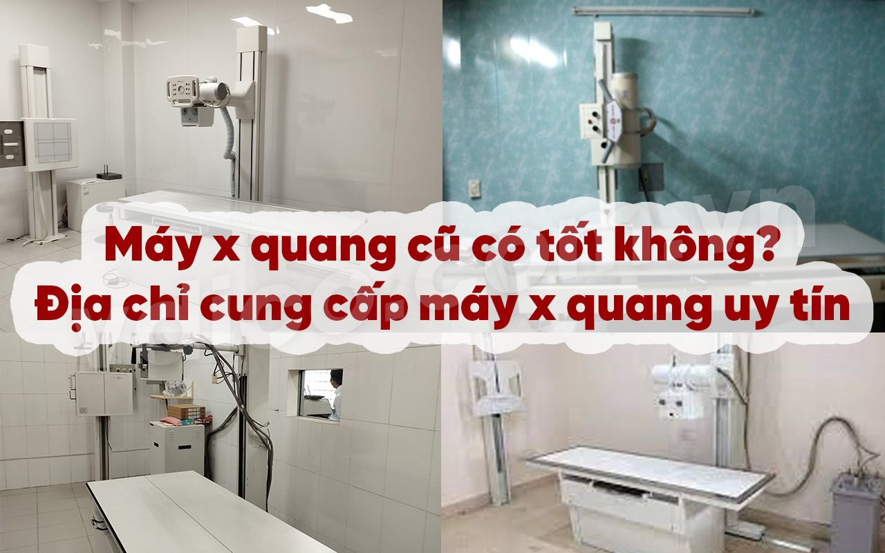 Máy x quang cũ có tốt không? Địa chỉ cung cấp máy x quang uy tín