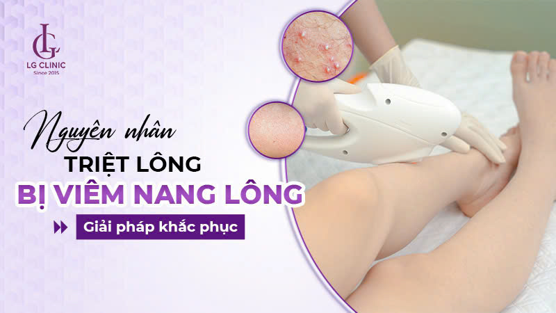 Vì sao triệt lông bị viêm nang lông? Có tự hết không?