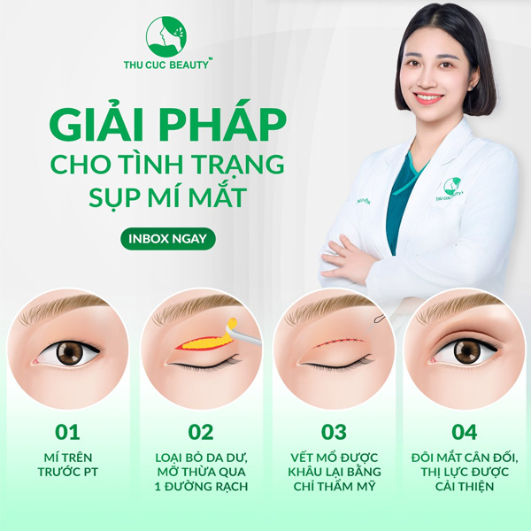 Phẫu thuật sụp mí mắt (nâng mí) - Bệnh viện Thẩm mỹ Thu Cúc