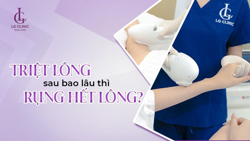 Triệt lông sau bao lâu thì rụng?