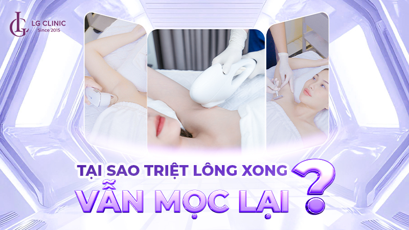 Tại sao triệt lông không hết? Triệt lông xong vẫn mọc lại?