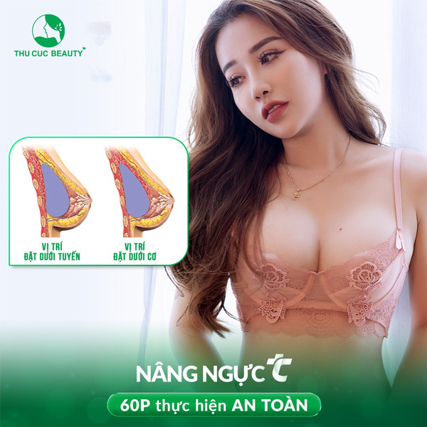 Phẫu Thuật Đặt Túi Ngực: Nâng Ngực Bằng Chất Liệu Độn