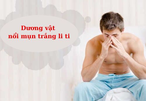 Dương vật nổi mụn trắng li ti là bị mắc bệnh gì?