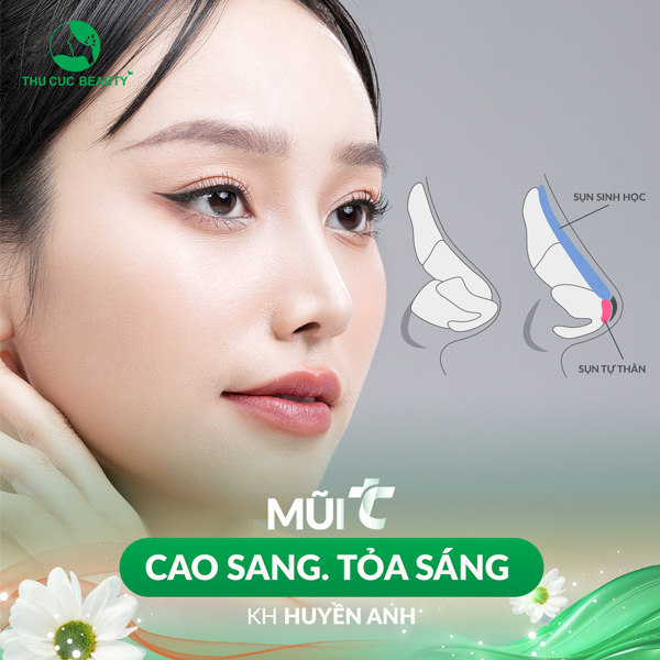 Nâng mũi bán cấu trúc - Bệnh viện Thẩm mỹ Thu Cúc