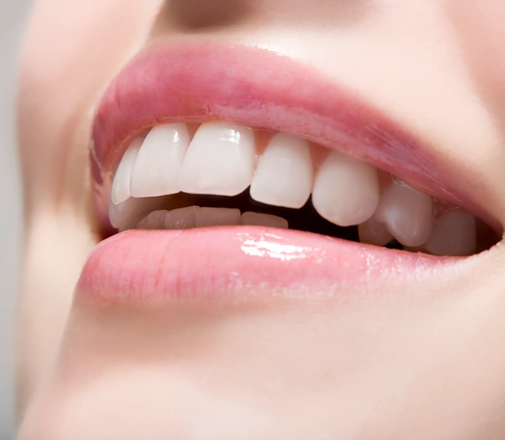 Choose Professional Teeth Cleaning in Dubai Investments Park