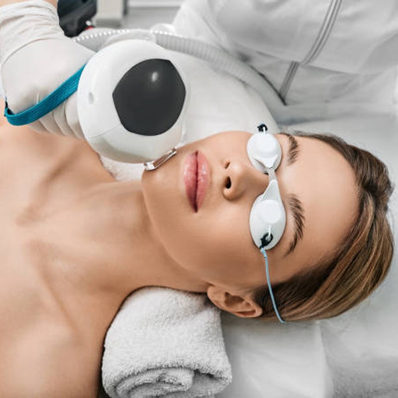 Best Photofacial treatment in Mohali, young skin with Photofacial