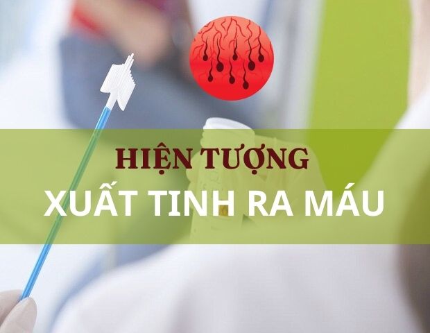 Khi có hiện tượng xuất tinh ra máu nam giới cần làm gì?