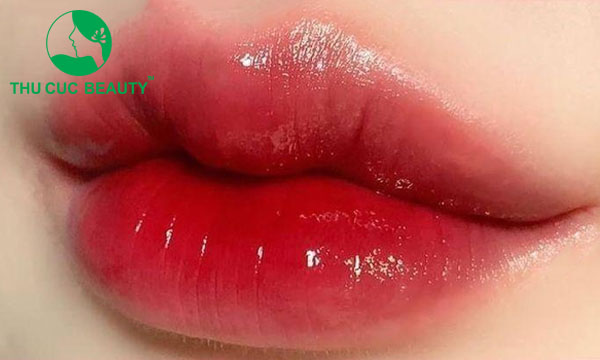 Tạo môi trái tim  - Bệnh viện Thẩm mỹ Thu Cúc