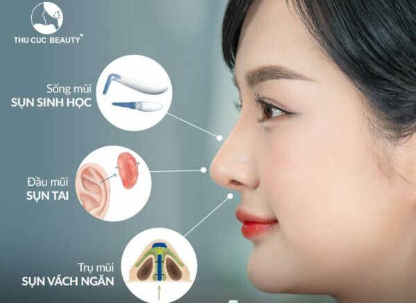 Nâng mũi sụn tai - Bệnh viện Thẩm mỹ Thu Cúc