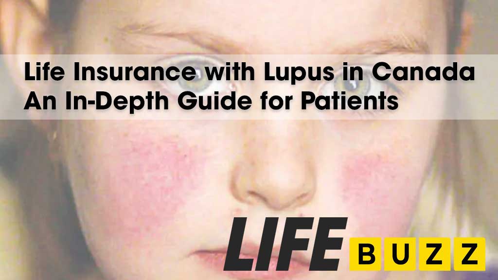 Life Insurance With Lupus In Canada: An In-Depth Guide