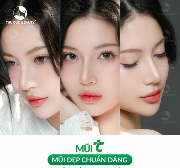 Nên nâng mũi cấu trúc hay bọc sụn? Phương pháp nào tốt hơn? - Bệnh viện Thẩm mỹ Thu Cúc