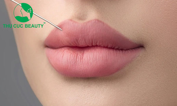 Tiêm môi tây là gì? Các dáng tiêm môi tây đẹp nhất hiện nay - Bệnh viện Thẩm mỹ Thu Cúc