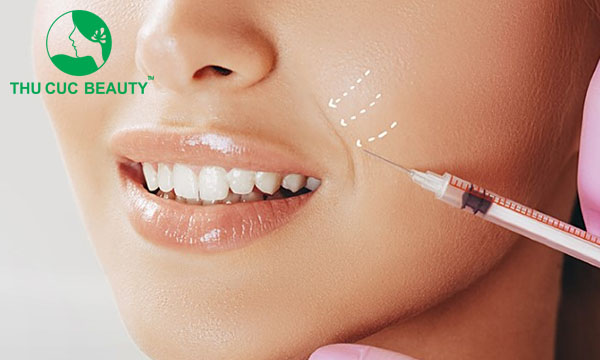 Tiêm rãnh cười kiêng gì để đẹp và không bị biến chứng? - Bệnh viện Thẩm mỹ Thu Cúc