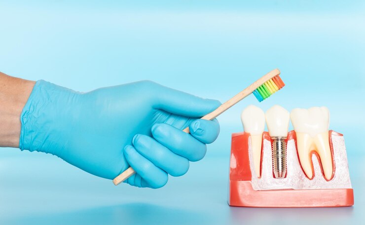 Implant Dentistry: Restoring Your Smiles and Enhancing Oral Function - AtoAllinks