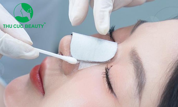 Nâng mũi bao lâu thì gom lại? - Bệnh viện Thẩm mỹ Thu Cúc