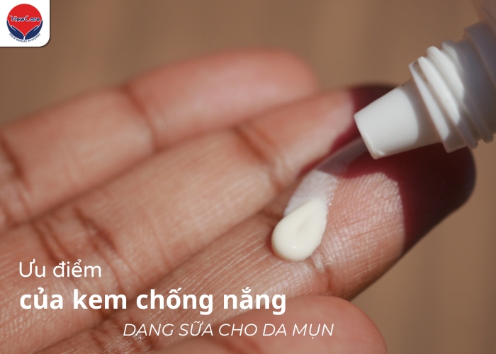 Kem chống nắng dạng sữa cho da mụn: Bí quyết bảo vệ da không bí tắc - Newcare - Mỹ phẩm Nhật Bản cao cấp