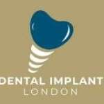 Dental Implants London