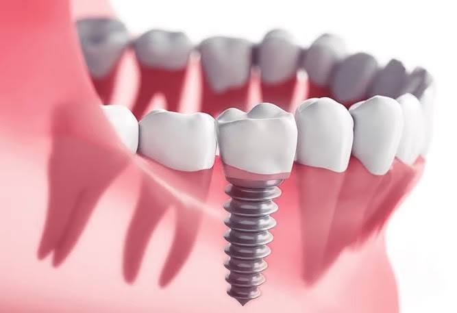 Orthodontist in RR Nagar