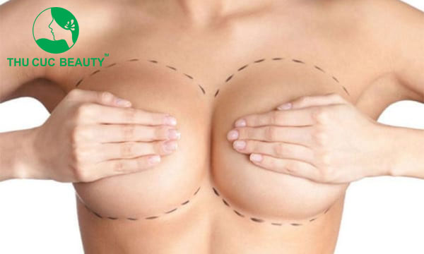 Có nên nâng ngực bằng mỡ tự thân không? - Bệnh viện Thẩm mỹ Thu Cúc