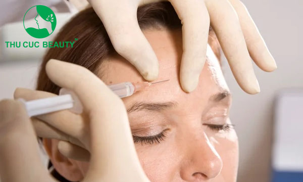 Tiêm botox xóa nhăn trán có an toàn không? - Bệnh viện Thẩm mỹ Thu Cúc