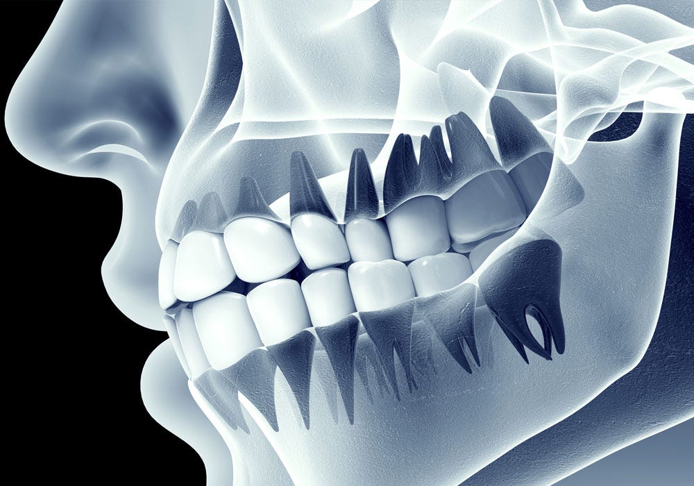 Dental X Ray Centres in RR Nagar. Early and accurate diagnosis is the key… | by Symphonysmiles | Jul, 2025 | Medium